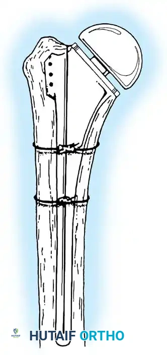 Hutaifortho's Orthopaedic Diagram