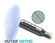 ARTHROSCOPIC SCREW FIXATION FOR OSTEOCHONDRITIS DISSECANS LESIONS IN THE MEDIAL FEMORAL CONDYLE Surgical Diagram