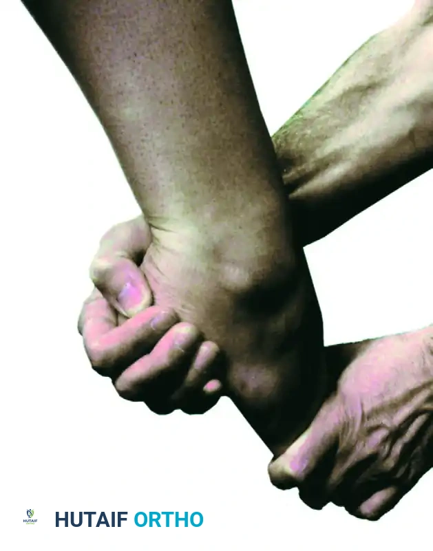 FIGURE 50-8 Noninvasive ankle distraction. SEE TECHNIQUE 50-1.