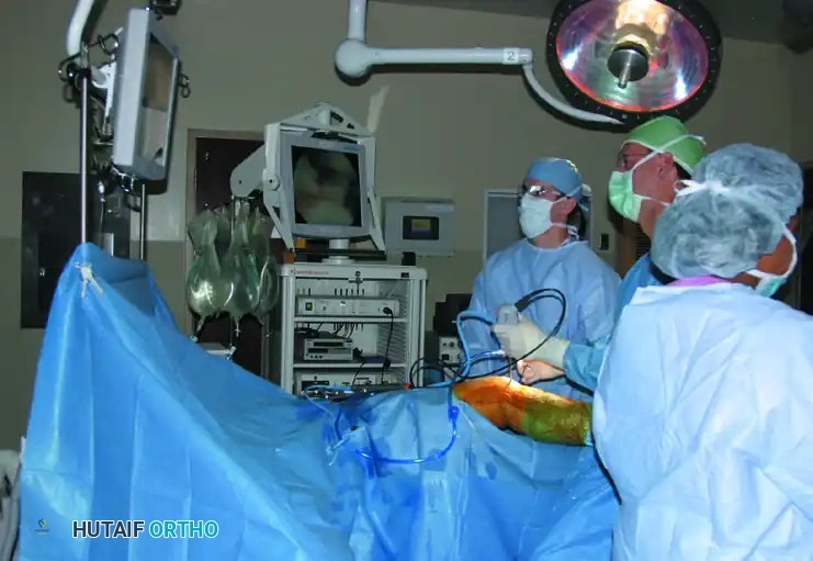 Mastering Knee Arthroscopy: Principles, Positioning, and Portal Anatomy