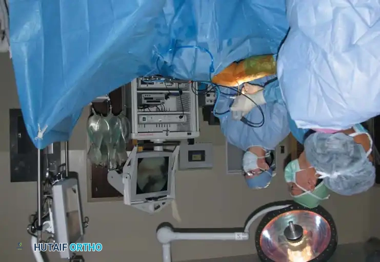 Fig. 48-3 Technique of table-ﬂ at position. Surgeon and assistant stand at side of table.
