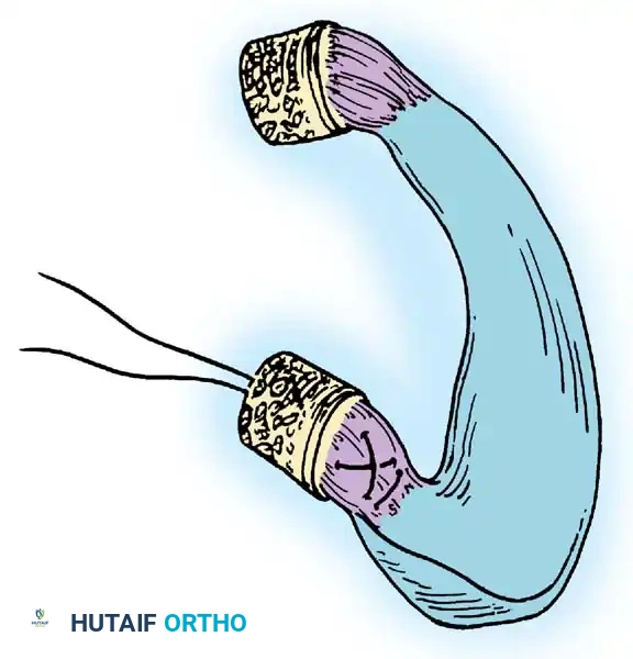 Arthroscopy of the Lower Extremity Surgical Diagram