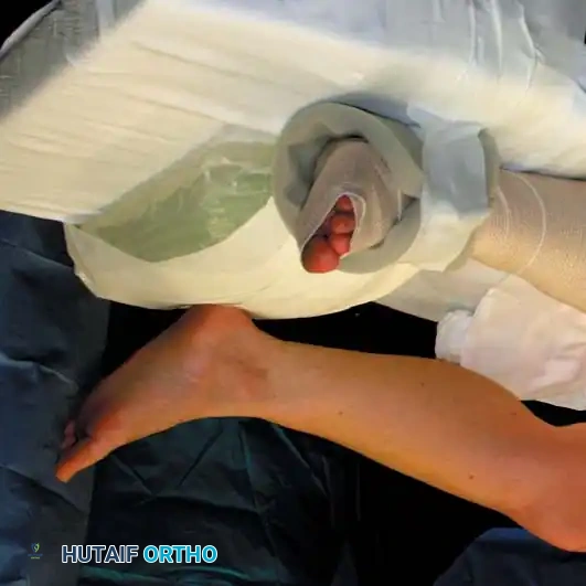 Arthroscopy of the Lower Extremity Surgical Diagram