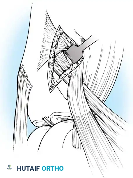 Arthroscopy of the Lower Extremity Surgical Diagram