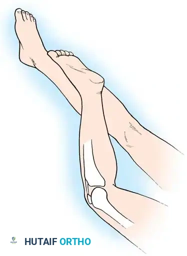 Arthroscopy of the Lower Extremity Surgical Diagram
