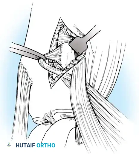 Arthroscopy of the Lower Extremity Surgical Diagram