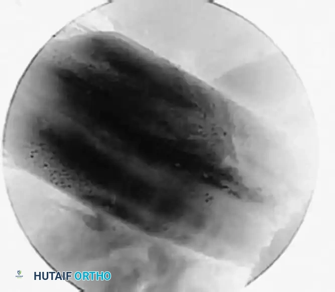 Arthroscopy of the Lower Extremity Surgical Diagram