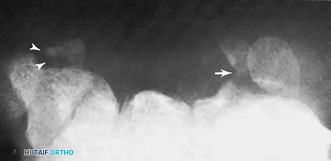 Masterclass in Wrist Arthroscopy: Indications, Techniques, and Outcomes