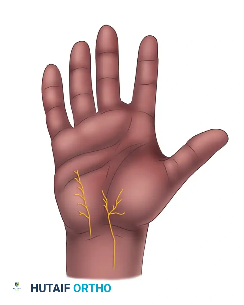 Distribution of subbranches of palmar cutaneous branches of median and ulnar nerves