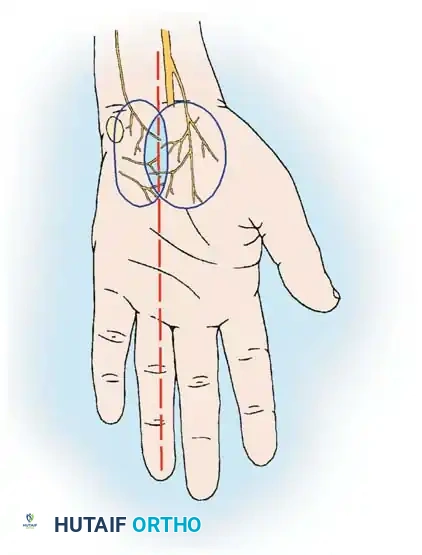 BASIC SKIN TECHNIQUE Surgical Diagram