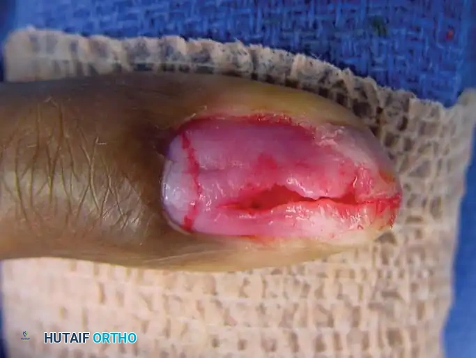 Hutaifortho's Orthopaedic Diagram