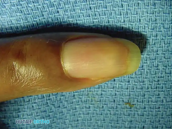 Hutaifortho's Orthopaedic Diagram