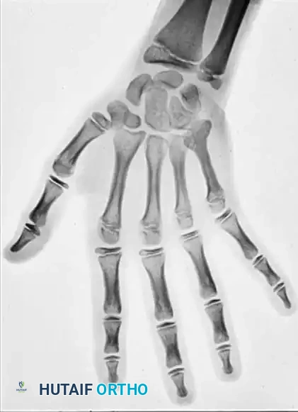 Hutaifortho's Orthopaedic Diagram