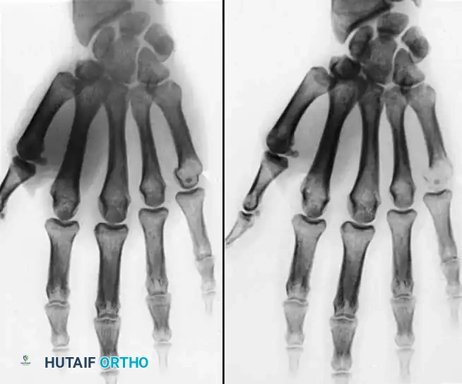 Hutaifortho's Orthopaedic Diagram