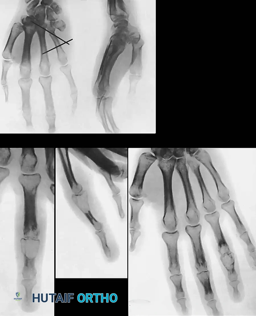 Hutaifortho's Orthopaedic Diagram