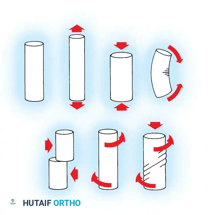 Biomaterials in Orthopaedic Fracture Fixation: A Comprehensive Academic Guide