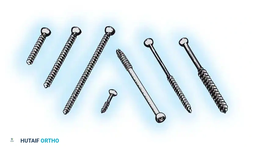 Fig. 50-21 Examples of cancellous and cortical screws for fracture ﬁ xation.