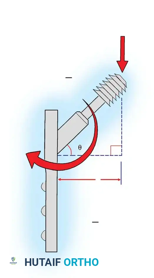Screw Angle