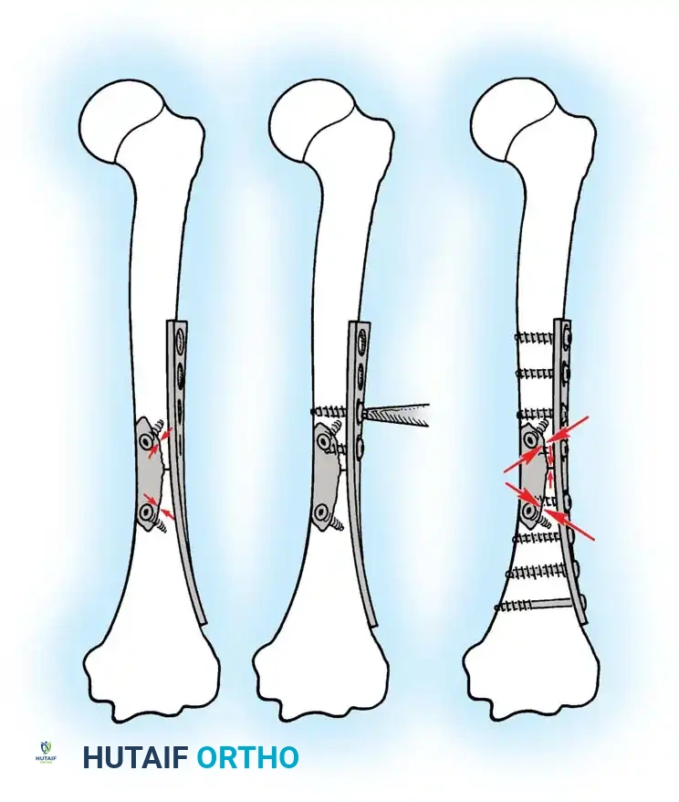 Hutaifortho's Orthopaedic Diagram