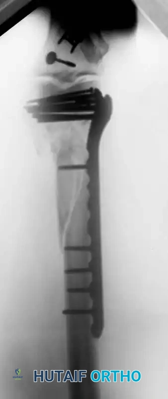 Hutaifortho's Orthopaedic Diagram