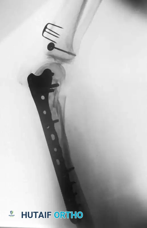 Hutaifortho's Orthopaedic Diagram