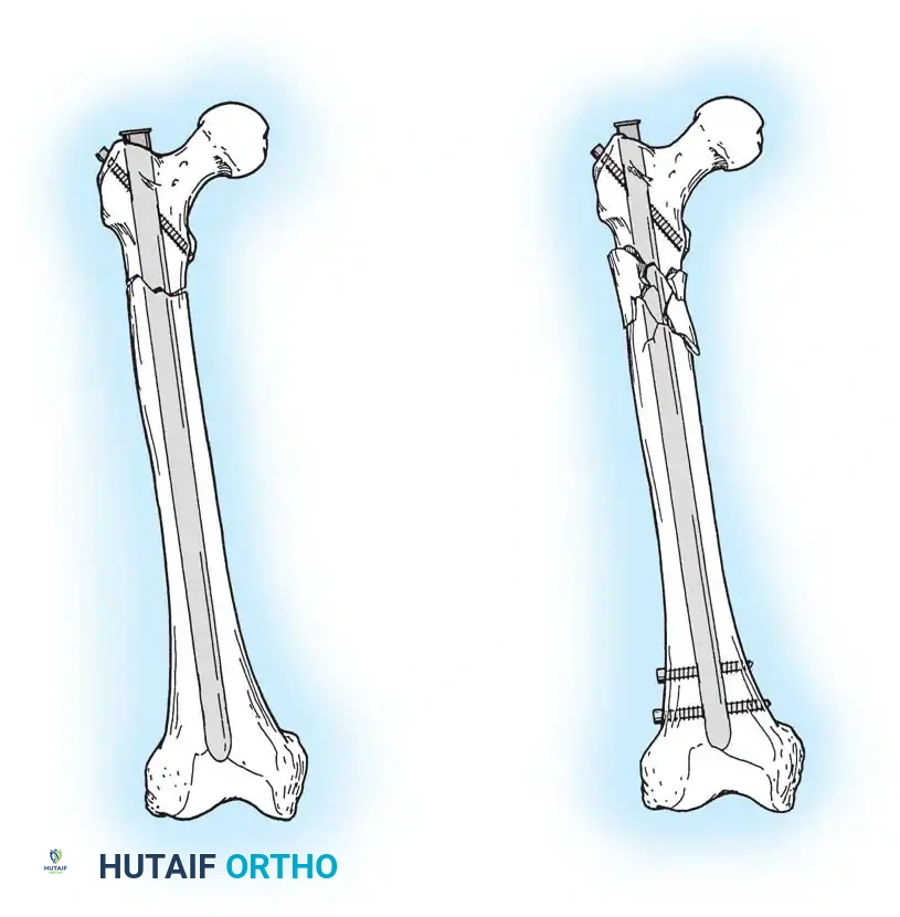 Hutaifortho's Orthopaedic Diagram