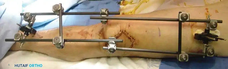 Hutaifortho's Orthopaedic Diagram