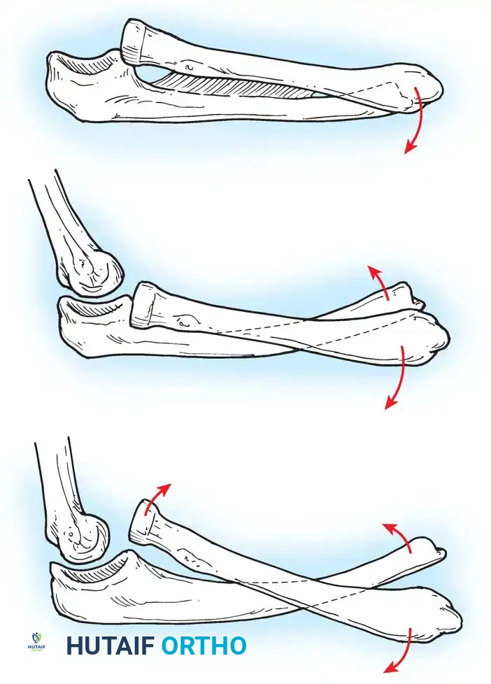BRACHIAL PLEXUS PALSY Surgical Diagram