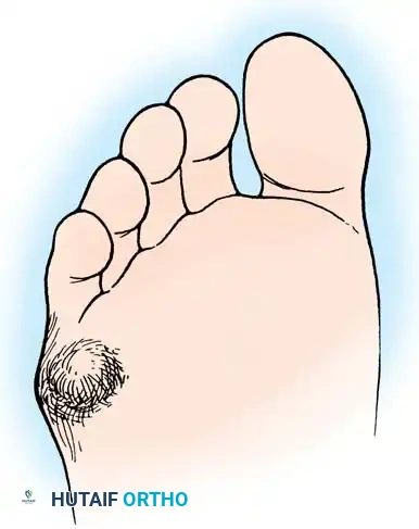 Hutaifortho's Orthopaedic Diagram