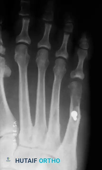 Hutaifortho's Orthopaedic Diagram