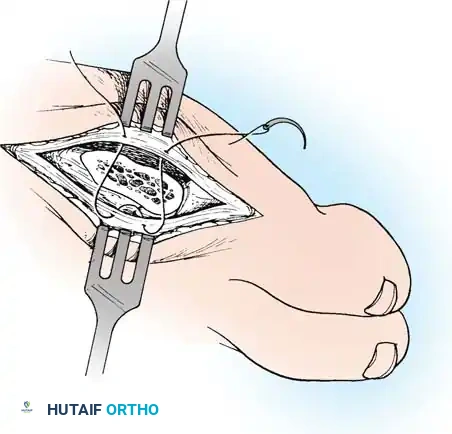 Hutaifortho's Orthopaedic Diagram