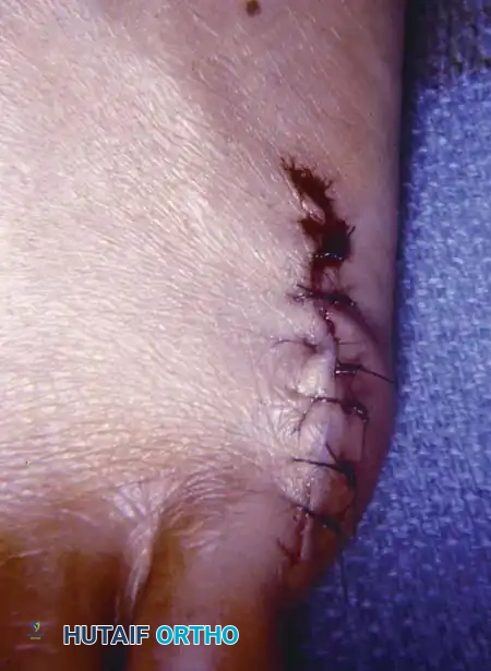 Hutaifortho's Orthopaedic Diagram