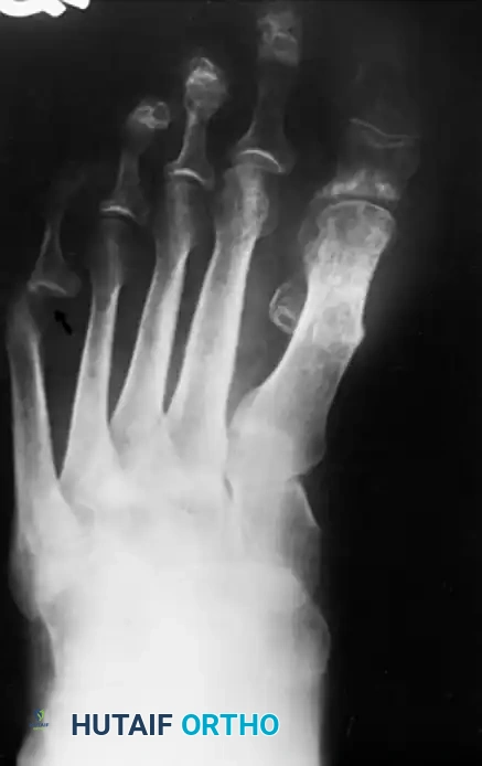 Hutaifortho's Orthopaedic Diagram