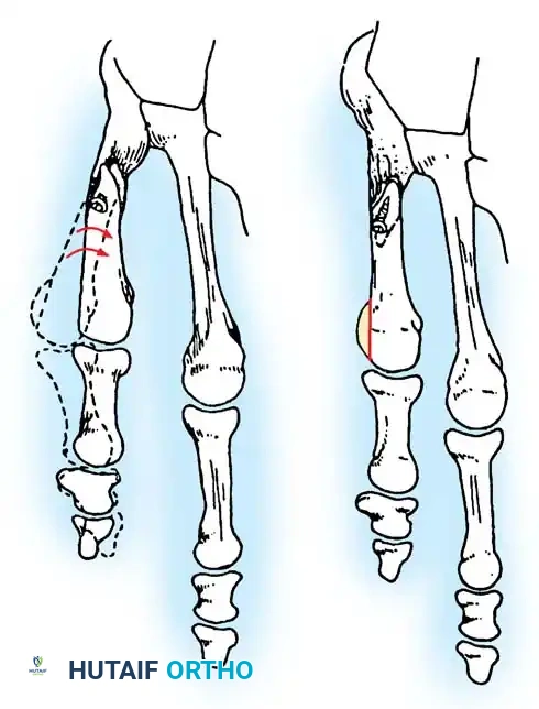 Hutaifortho's Orthopaedic Diagram