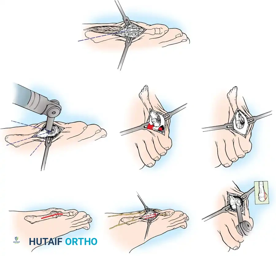 Hutaifortho's Orthopaedic Diagram