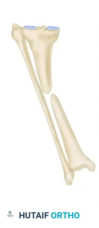CANCELLOUS INSERT GRAFTS Surgical Diagram