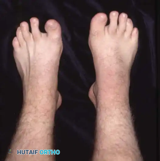 Hutaifortho's Orthopaedic Diagram