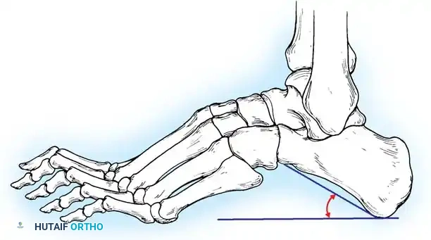 Radiographic Evaluation