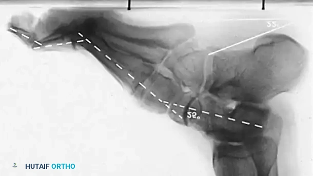 Hutaifortho's Orthopaedic Diagram