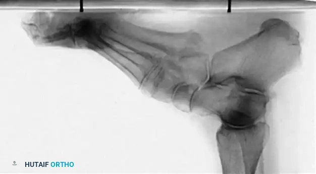 Hutaifortho's Orthopaedic Diagram