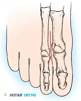 Hutaifortho's Orthopaedic Diagram