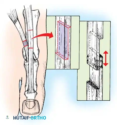 Hutaifortho's Orthopaedic Diagram