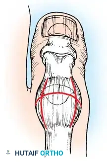 Hutaifortho's Orthopaedic Diagram