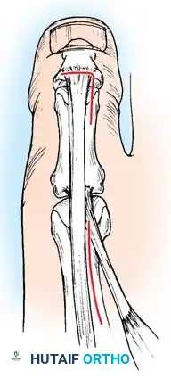 Hutaifortho's Orthopaedic Diagram