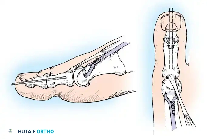 Hutaifortho's Orthopaedic Diagram