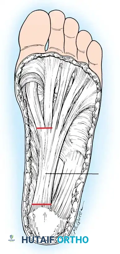 Hutaifortho's Orthopaedic Diagram
