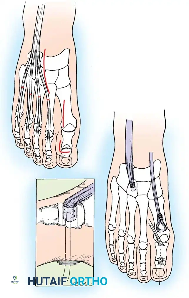 Hutaifortho's Orthopaedic Diagram