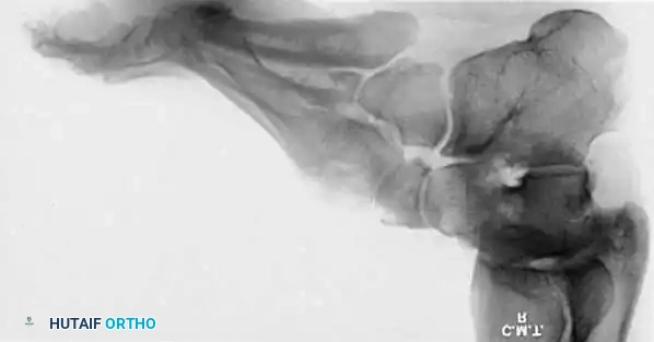 Hutaifortho's Orthopaedic Diagram