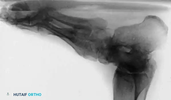 Hutaifortho's Orthopaedic Diagram