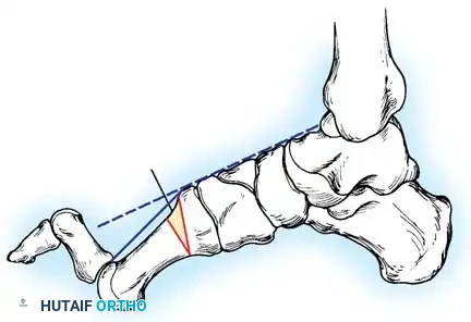 Hutaifortho's Orthopaedic Diagram